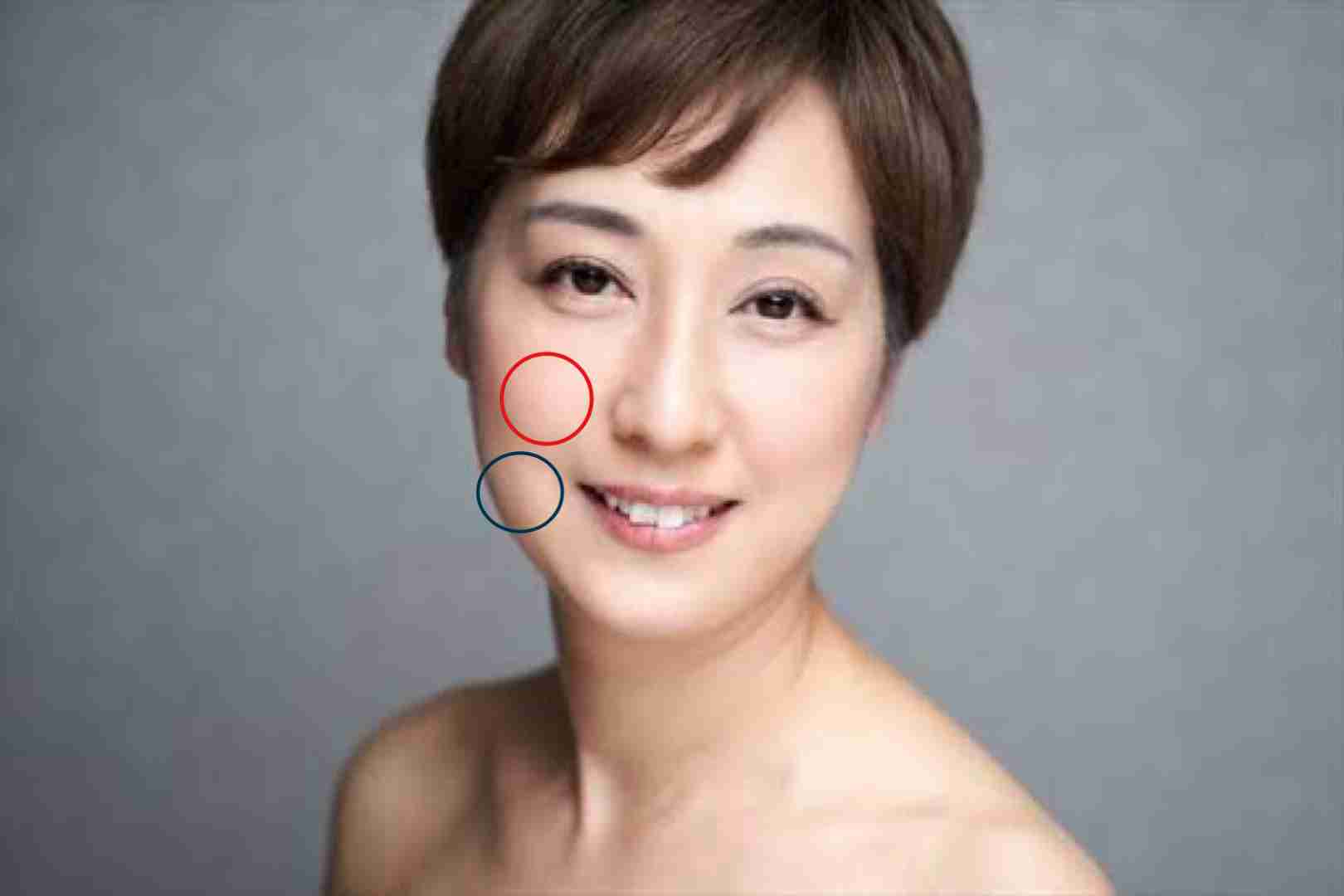 【コンプレックス】笑うと頬が盛り上がる
