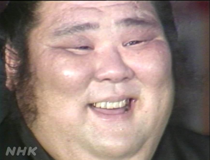 【コンプレックス】笑うと頬が盛り上がる
