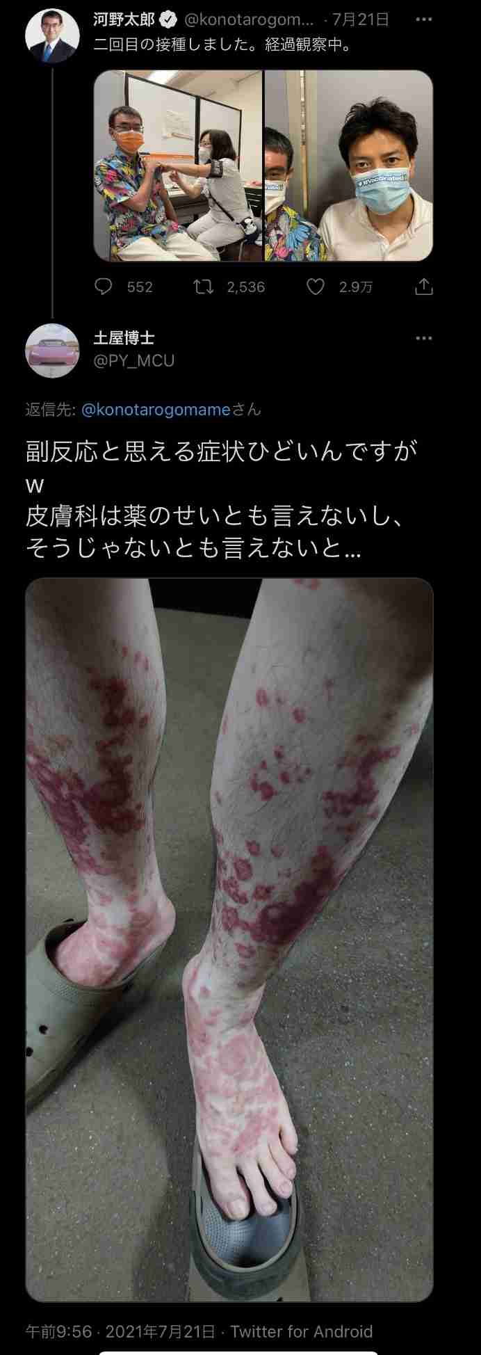 【速報】河野大臣、ブースター接種「たぶん来年打つことになる」