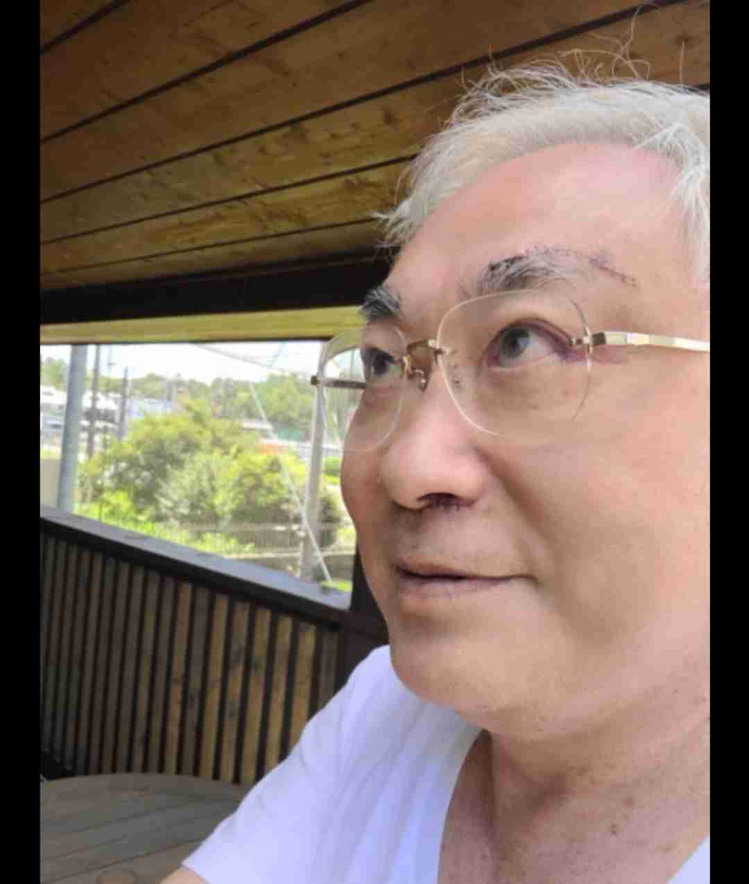 高須克弥院長、がん治療後即整形手術　眉と鼻下「クリニック若返り技術を見せる」