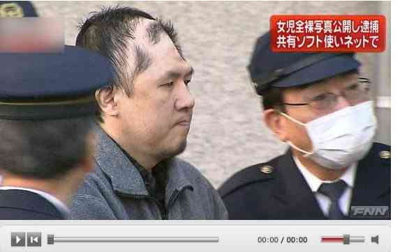 頭がいびつな形をしている人