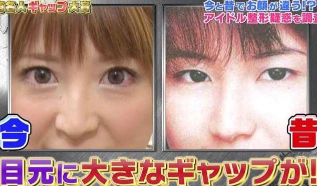 整形なしで顔を変える努力をしてる人
