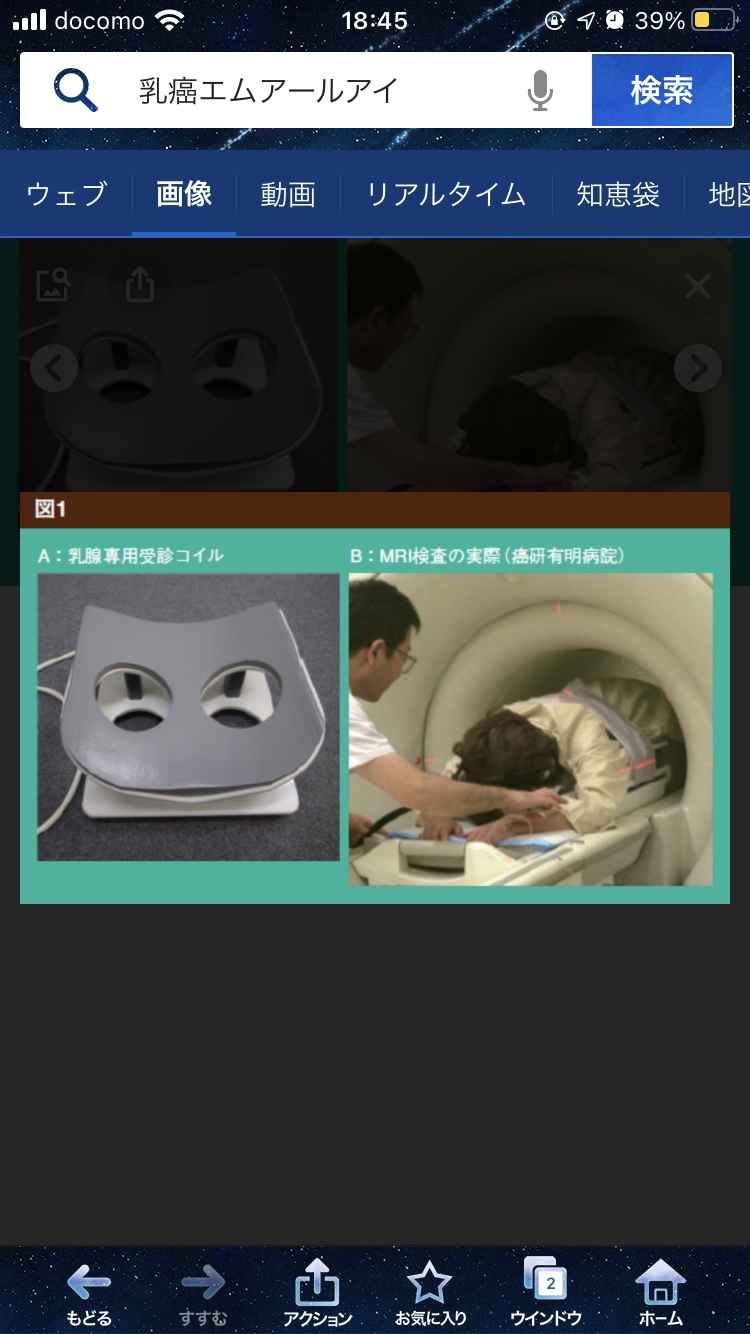 乳癌で再検査になった方！！