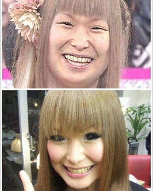 醜形恐怖症の人