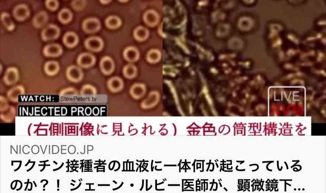 《ワクチン接種後の死亡746例》を徹底分析、“基礎疾患・常用薬・死因”の結果に愕然