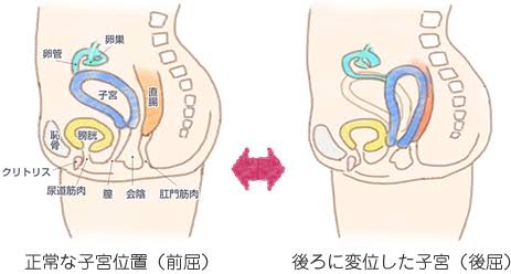 「お腹が痛い」と感じた4時間後に出産　妊娠に気づかなかった女性の衝撃体験