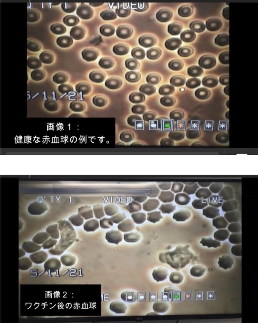 感染の野々村真 自宅療養で悪化「重度の肺炎」で入院 妻・俊恵「肺真っ白」「酸素吸入」と明かす