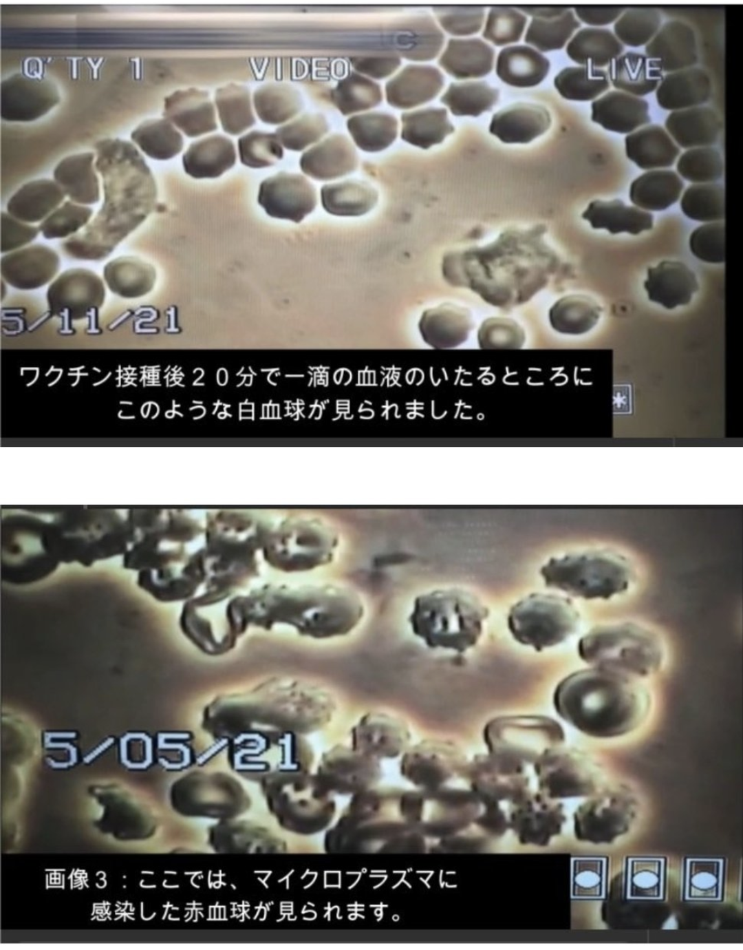 感染の野々村真 自宅療養で悪化「重度の肺炎」で入院 妻・俊恵「肺真っ白」「酸素吸入」と明かす