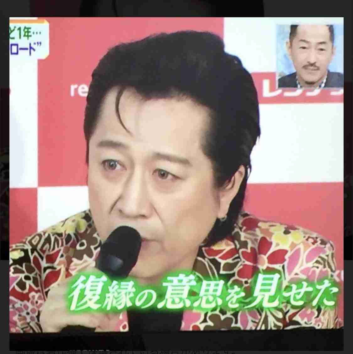 カラコンをやめたきっかけ