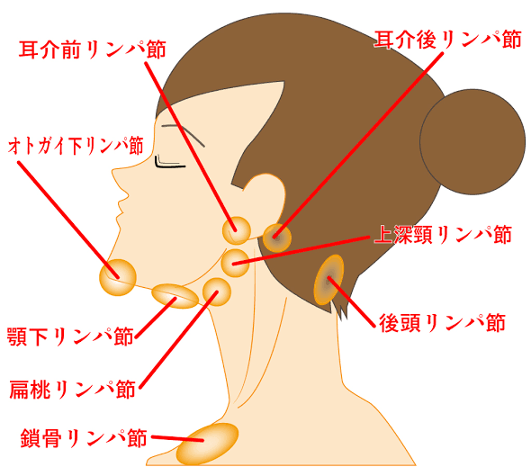 しこり恐怖症の集い