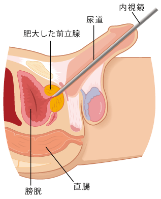 【画像閲覧注意】性器にUSBケーブルを挿入した15歳少年「サイズを測りたかった」（英）