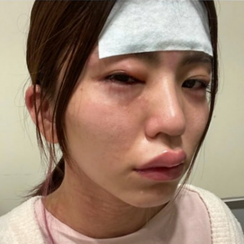 尾身氏、ワクチン3回目検討提案 宣言解除後の緩和に慎重求める