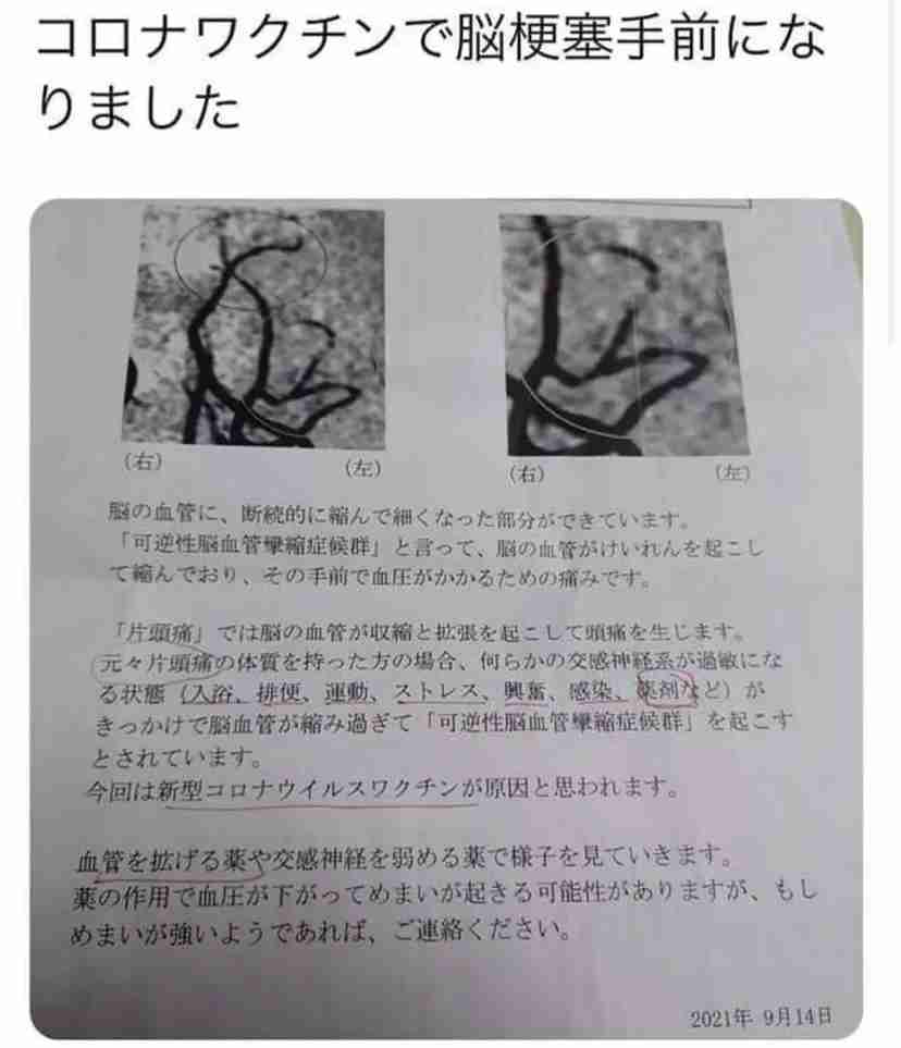 新型コロナ 東京都で新たに831人の感染確認