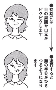 こんな症状よくあること？