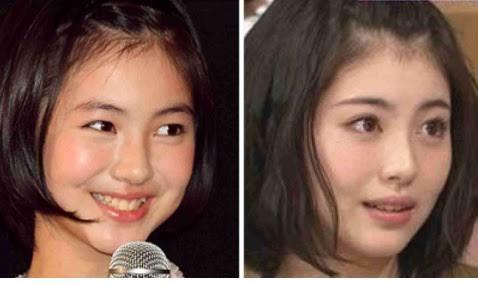浜辺美波、自身初の水着カットも 20歳記念写真集決定