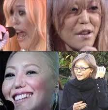 美容整形の怖い話part3