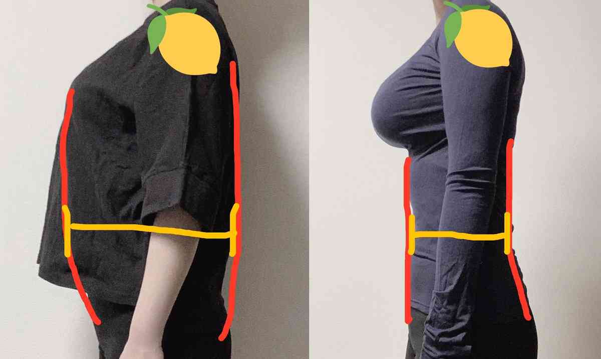 大金かけFカップ巨乳の縮小手術した女性　9ヶ月後に元のサイズに逆戻り（米）