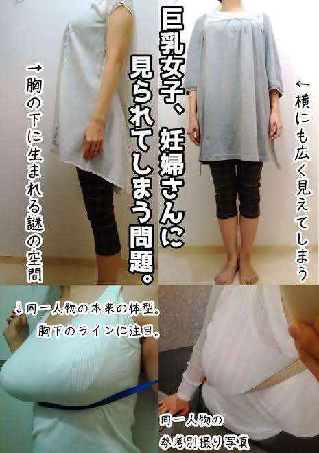 大金かけFカップ巨乳の縮小手術した女性　9ヶ月後に元のサイズに逆戻り（米）