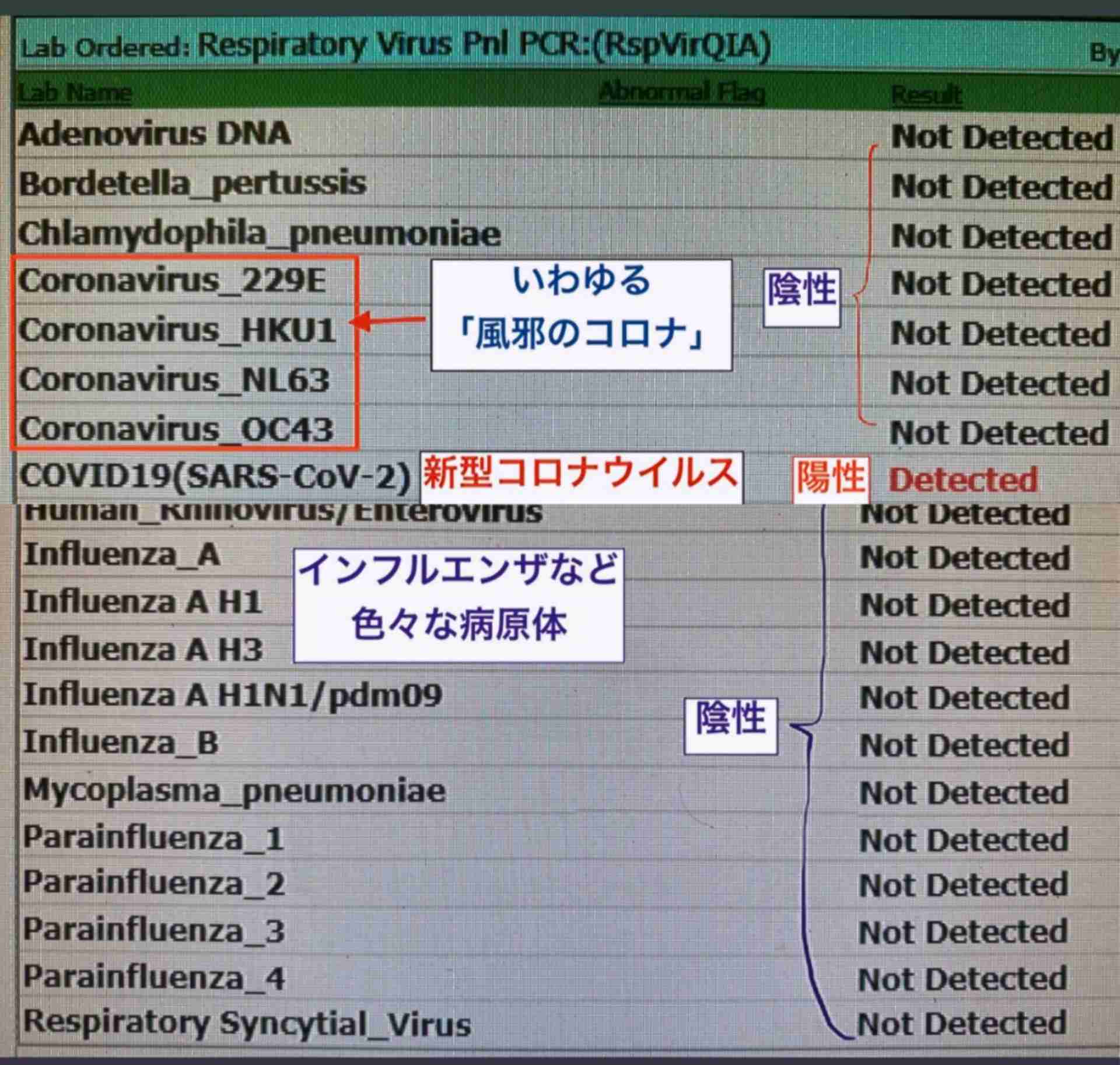 コロナウイルスに疲れた人が立ち寄るトピPart19