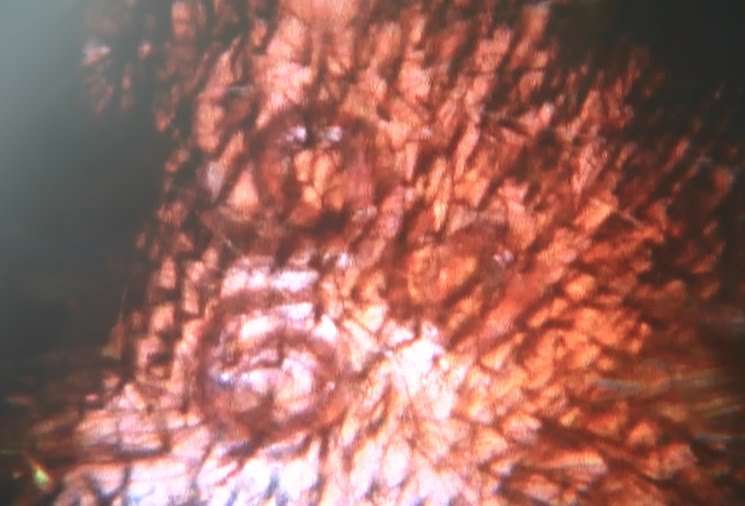 “666”は不吉なタトゥー？　胸に数字のタトゥーを入れた女性に通りがかりの男性が猛抗議「あなたには悪魔が憑りついている」