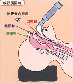 意識がなくなっても痛みは感じる？ 知られざる「全身麻酔」の世界