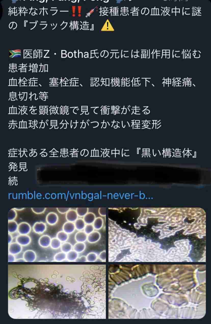 「ワクチン打った?」に気が重く…接種前提の空気感に違和感