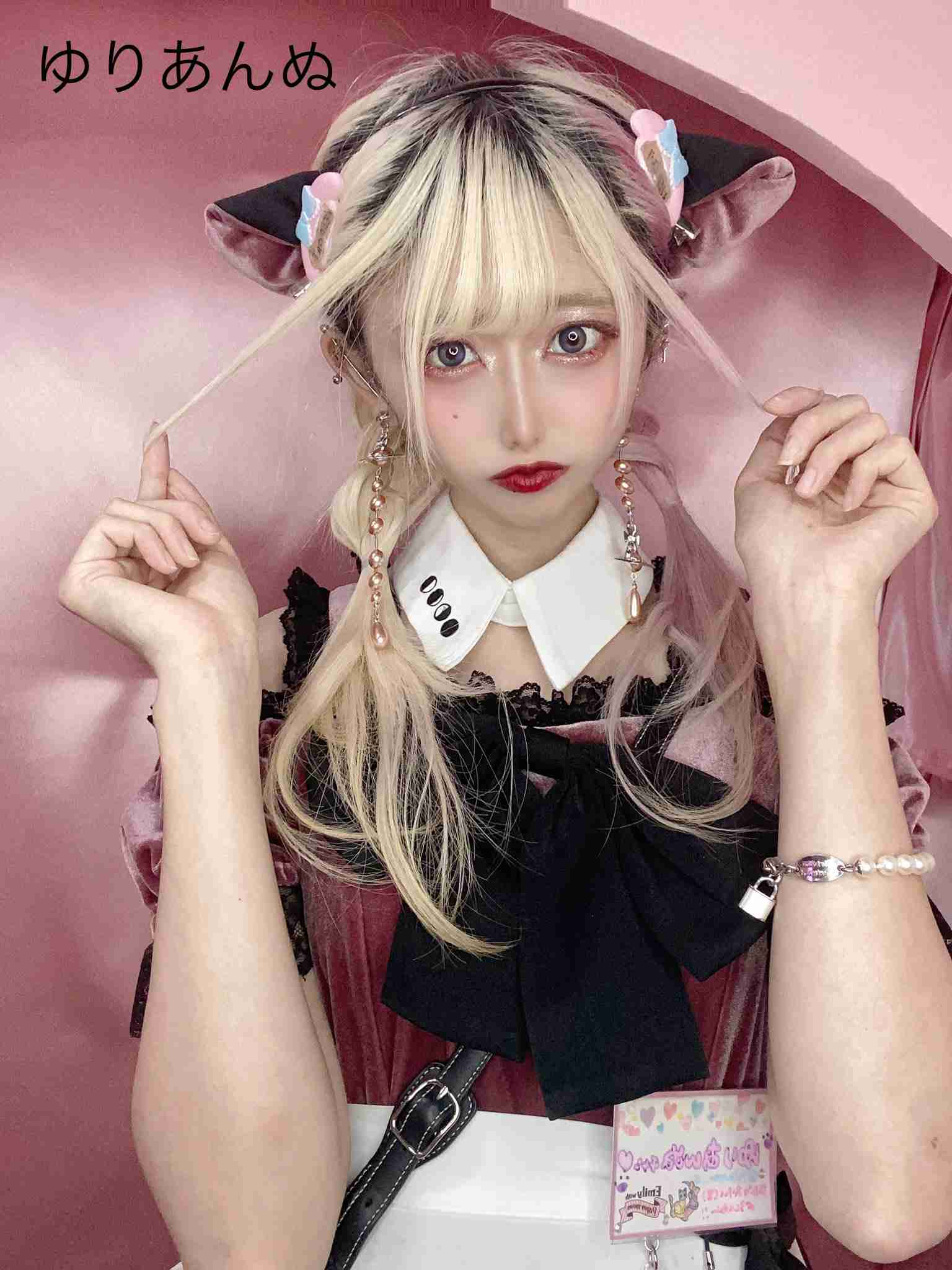 お直し総額は1億円超え! 元祖整形男子・アレンが語る「大失敗した施術」と顔面の惨劇