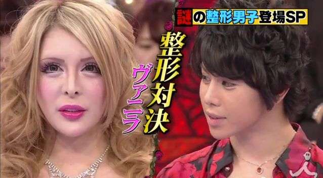 お直し総額は1億円超え！ 元祖整形男子・アレンが語る「大失敗した施術」と顔面の惨劇 | ガールズちゃんねる - Girls Channel