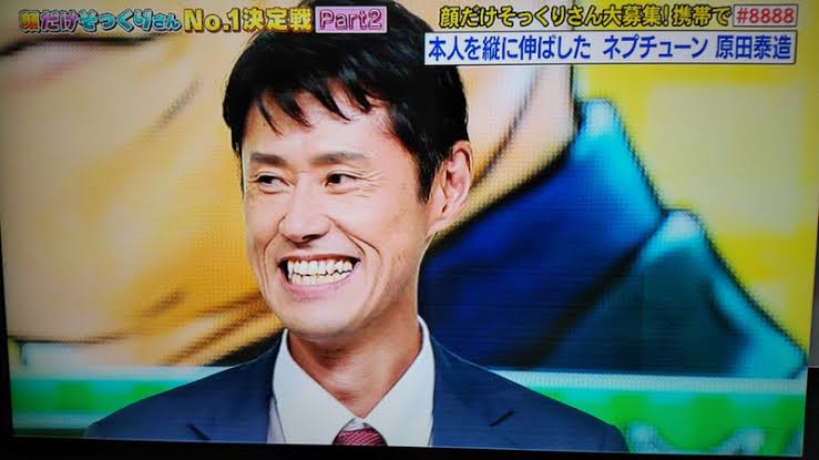 お直し総額は1億円超え! 元祖整形男子・アレンが語る「大失敗した施術」と顔面の惨劇