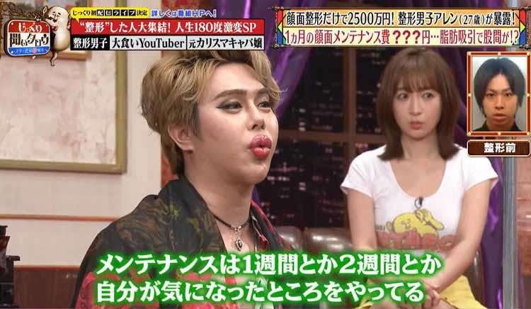お直し総額は1億円超え! 元祖整形男子・アレンが語る「大失敗した施術」と顔面の惨劇