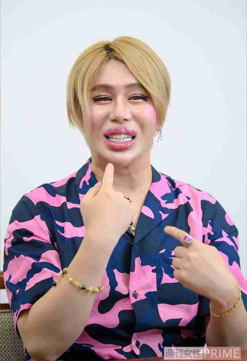 お直し総額は1億円超え！ 元祖整形男子・アレンが語る「大失敗した施術」と顔面の惨劇 | ガールズちゃんねる - Girls Channel
