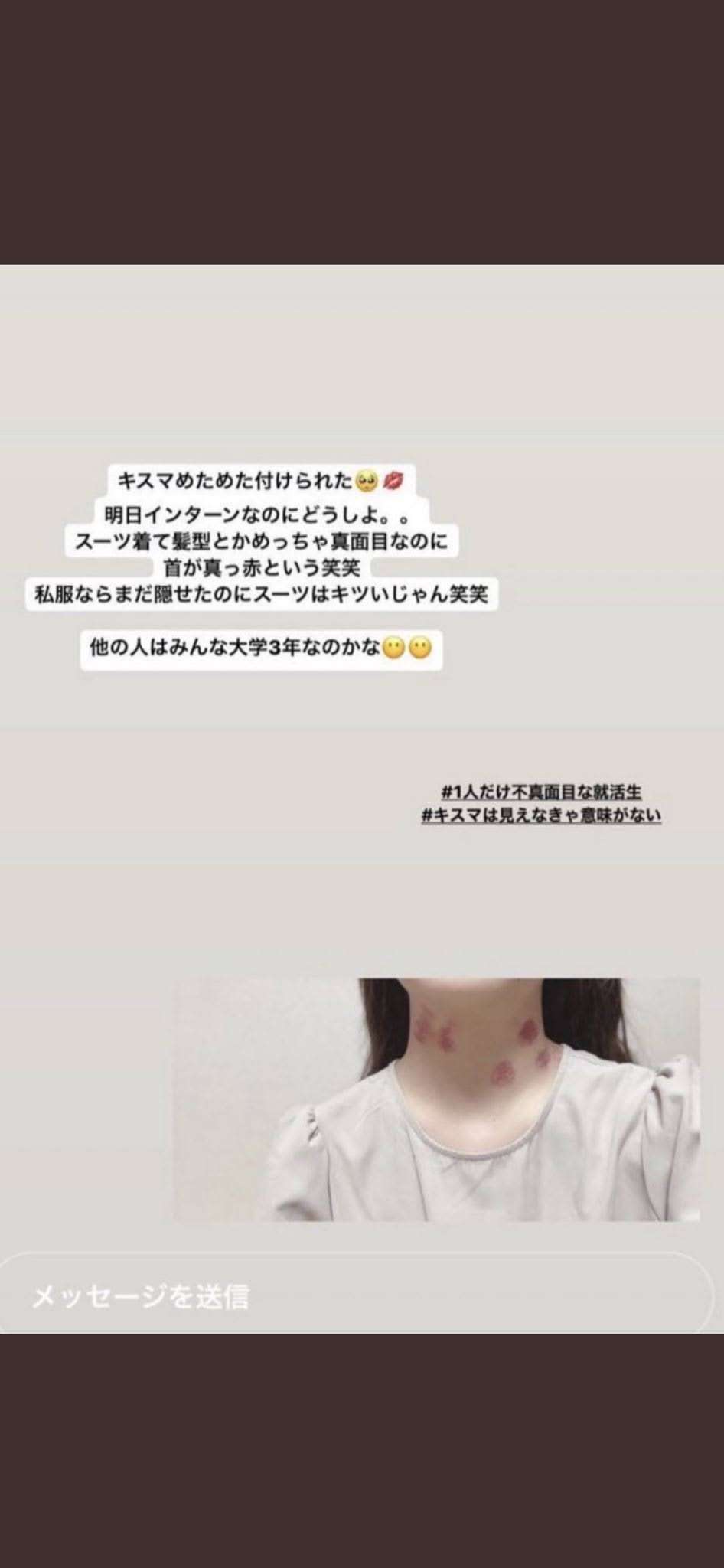 承認欲求が隠しきれない人の特徴