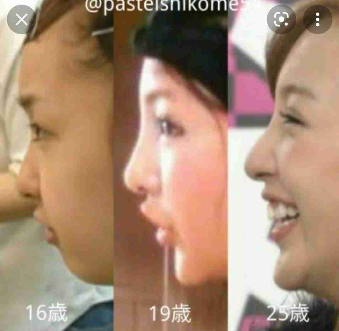 自分の横顔が嫌いな人ー！