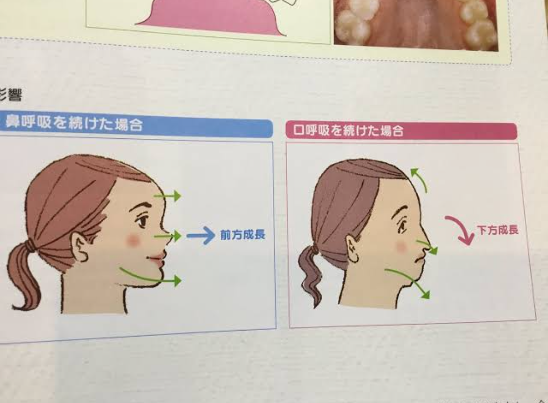 自分の横顔が嫌いな人ー！