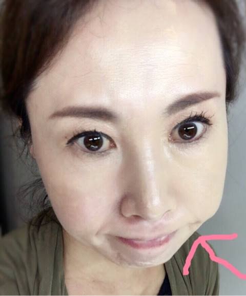 【悩み相談】お肌の曲がり角