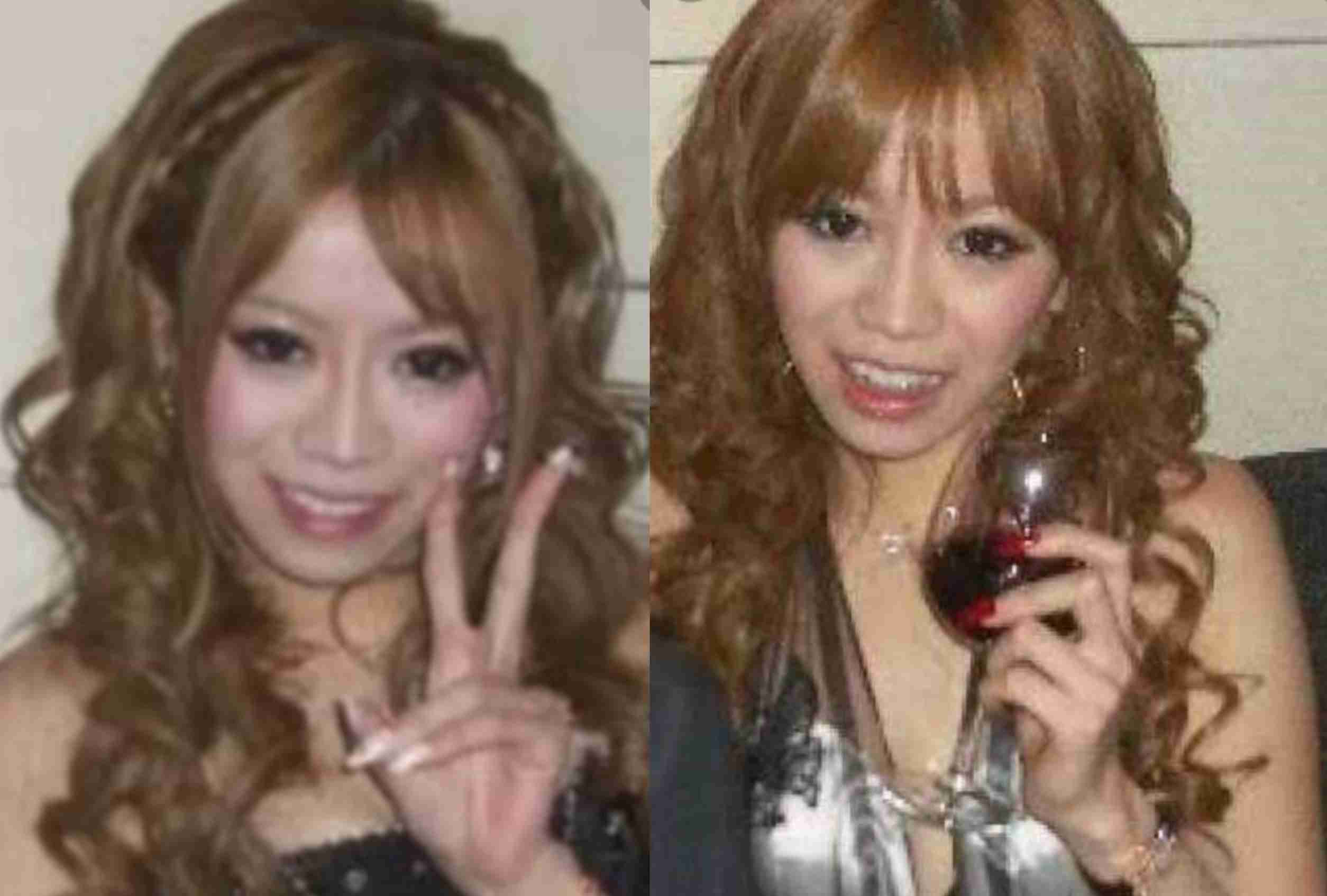 元NO.1キャバ嬢・愛沢えみりさん、これまでに受けた美容整形を語る　「安易に整形してはダメだと思った」「やっぱ顔大事だよね」と反響