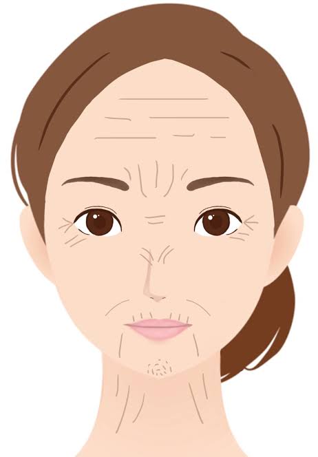 【笑い皺？】鼻筋に縦シワ