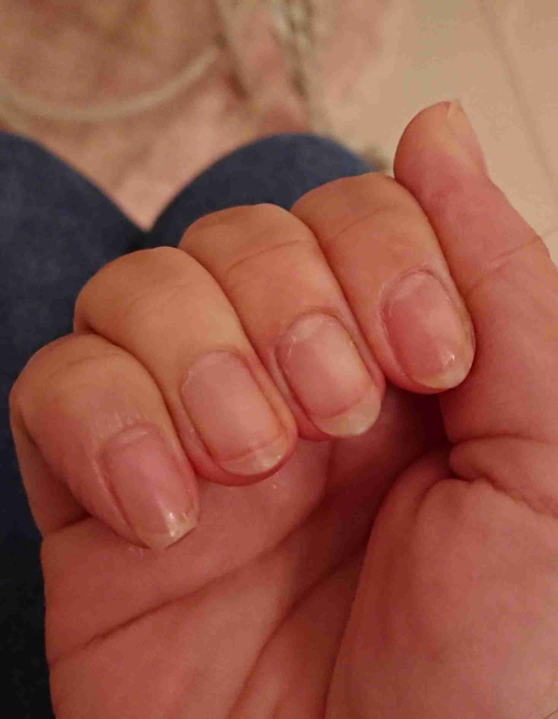 「シャンプーが地獄」やめたくてもやめられない、“爪を噛む癖”に苦しんだ漫画に共感続々「私も爪噛んじゃいます」