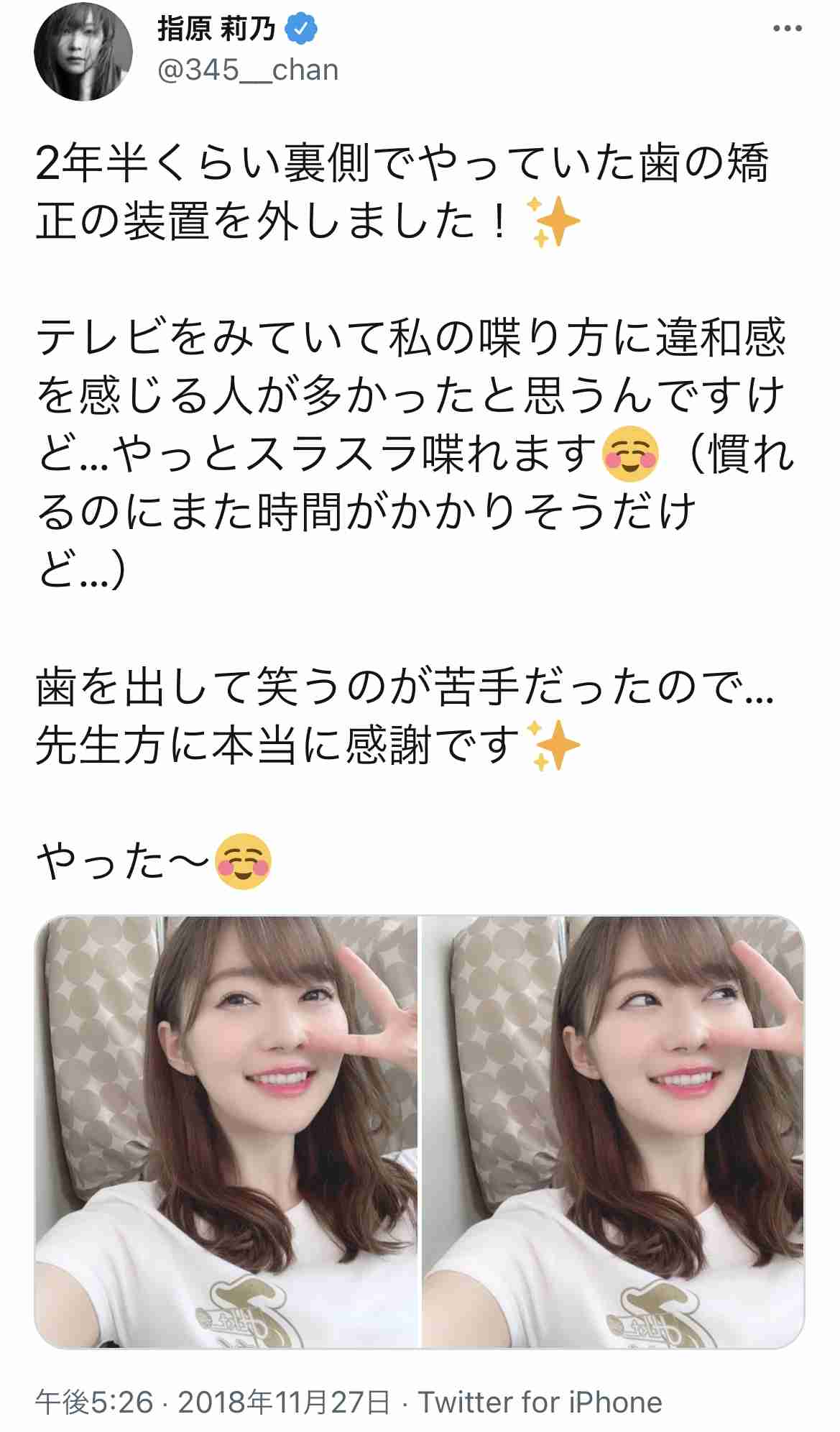 大人になってから歯列矯正をした方