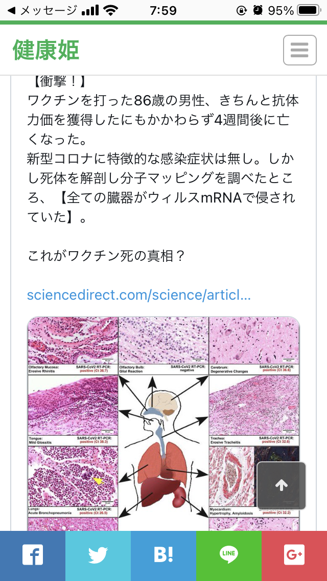 【コロナ】ワクチン3回目、打ちますか？