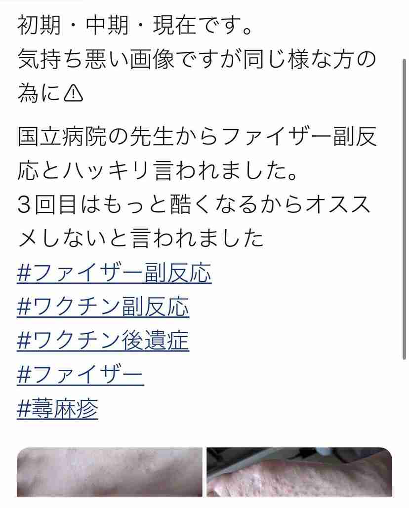 【コロナ】ワクチン3回目、打ちますか?