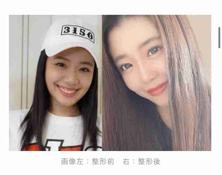 鼻整形告白の亀田3兄弟の妹・姫月、全身黒コーデの最新ショット「お人形みたいに可愛い」「モデル」