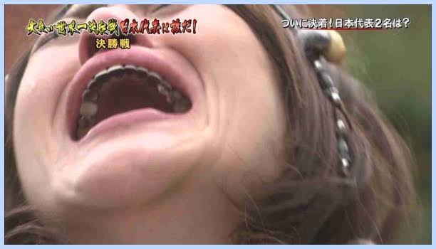銀歯ある人