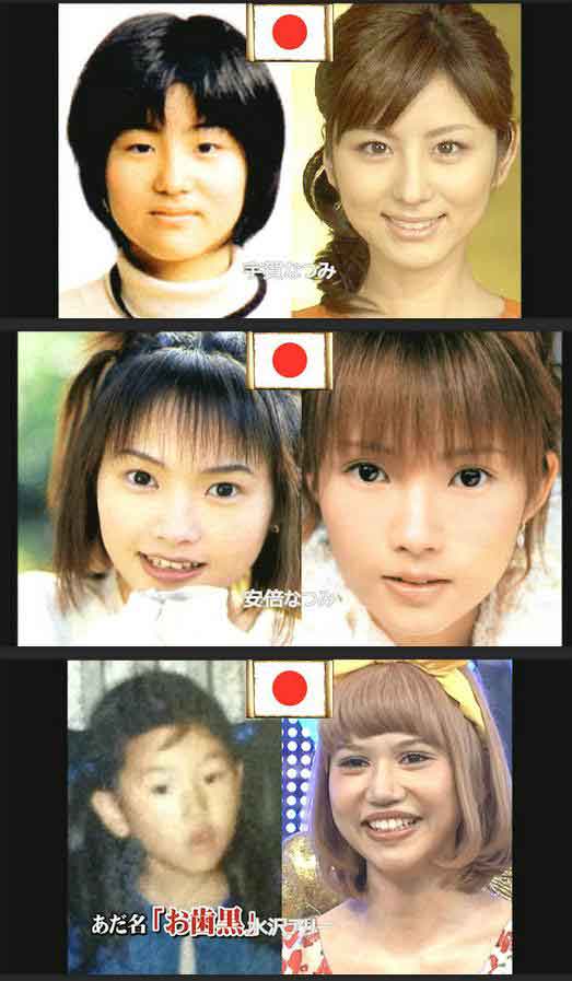 イメチェン前後の画像を貼るトピ