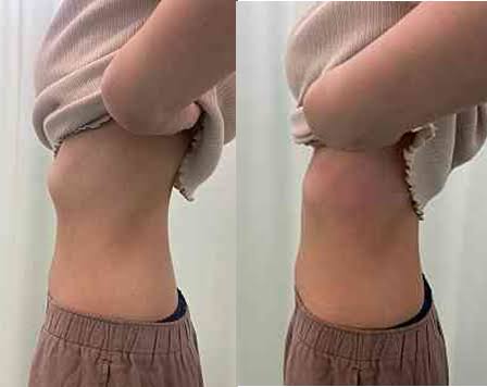 骨格ストレート【総合2021】