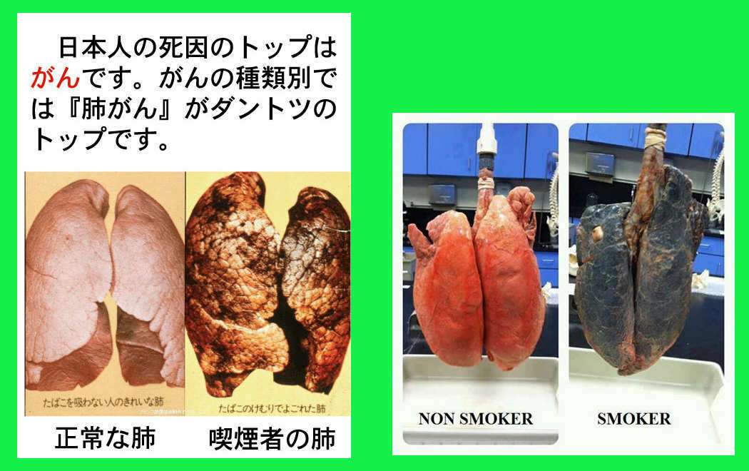 NZ、若年層のたばこ購入を生涯禁止へ　27年から