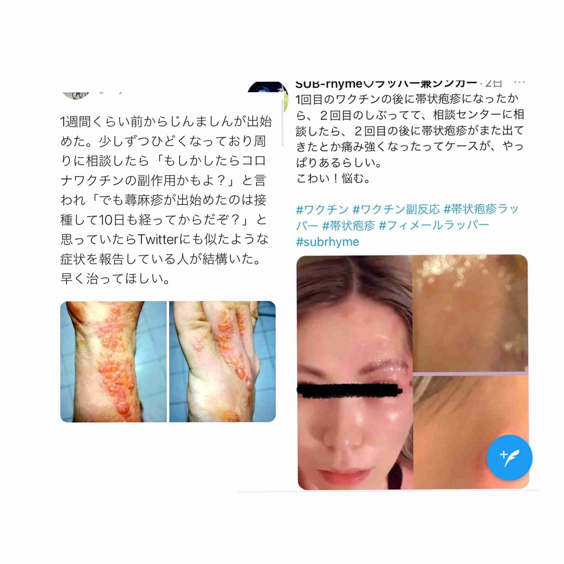 King & Prince・平野紫耀が心身の限界で帯状疱疹、「ポスト嵐」を背負うエースの現実