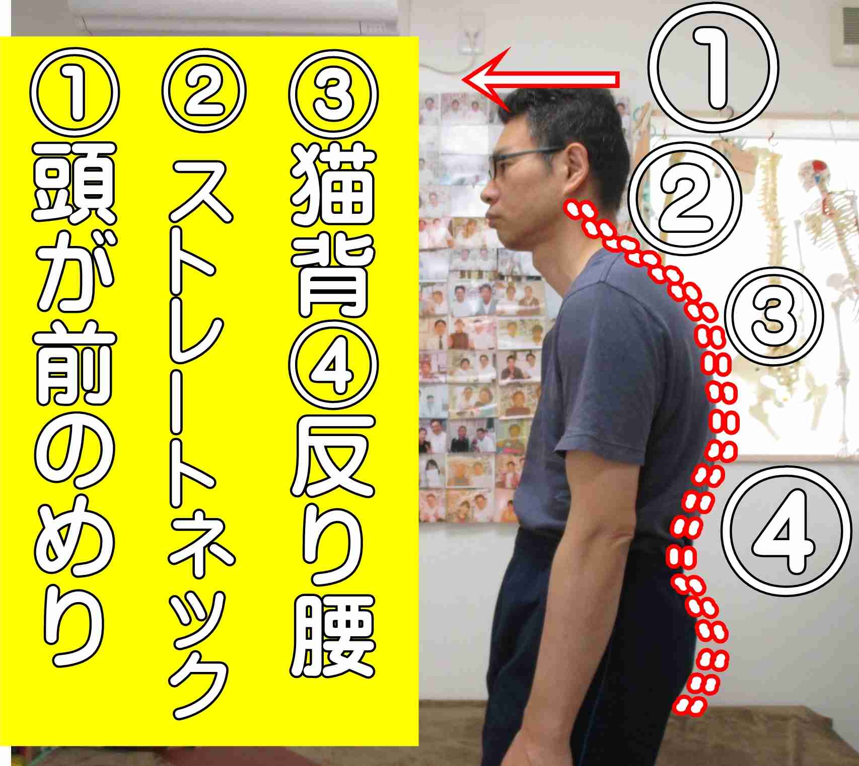 反り腰をどうにかしたい人！