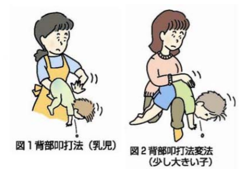咄嗟に体が動いた。保安検査場の職員がベルトコンベアを飛び越え、窒息状態の赤ちゃんを救う
