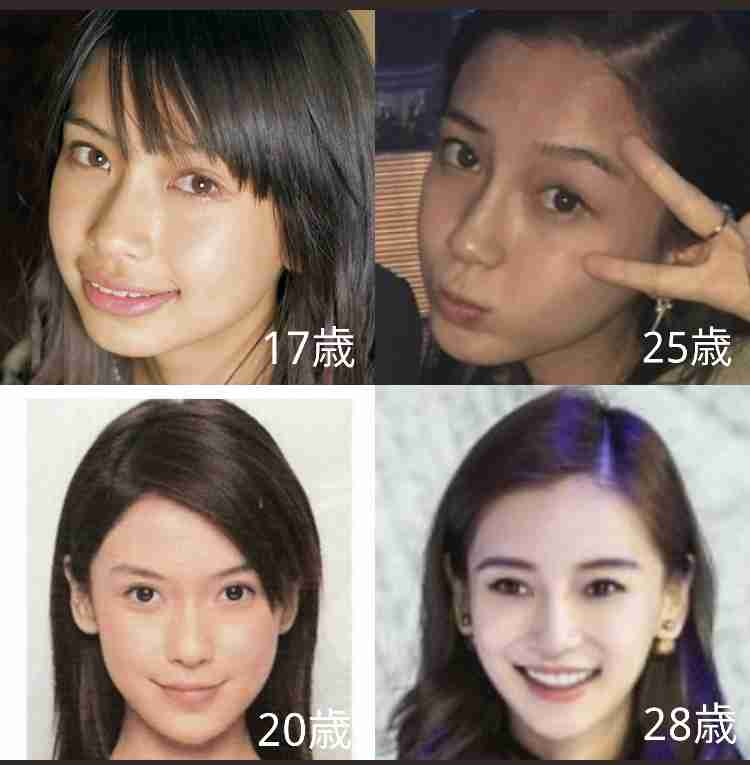 【整形美女】フル整形3周、課金額3000万円…施術をくり返してわかった「他者の評価に流されない軸を持つこと」の大切さ